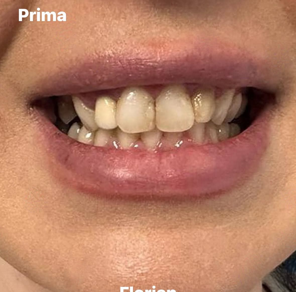 Prima del trattamento dentale