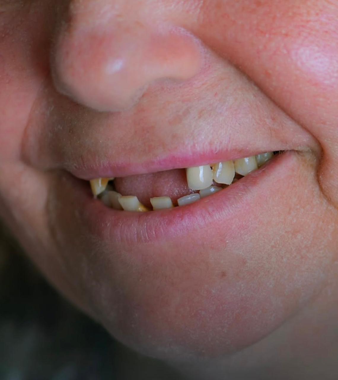 Prima del trattamento dentale